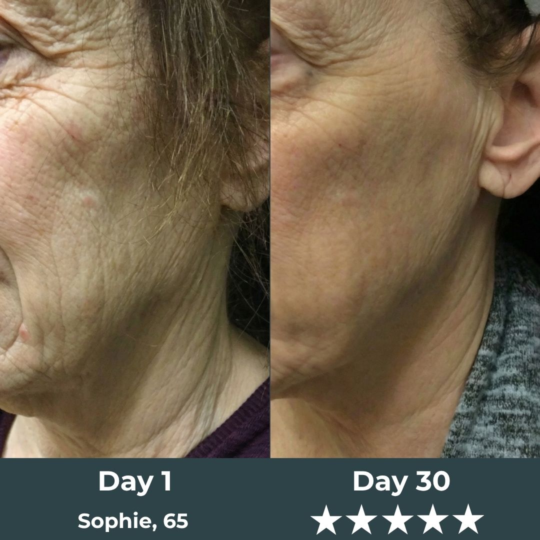 Kranla - 7 in 1 LED facial sculptor