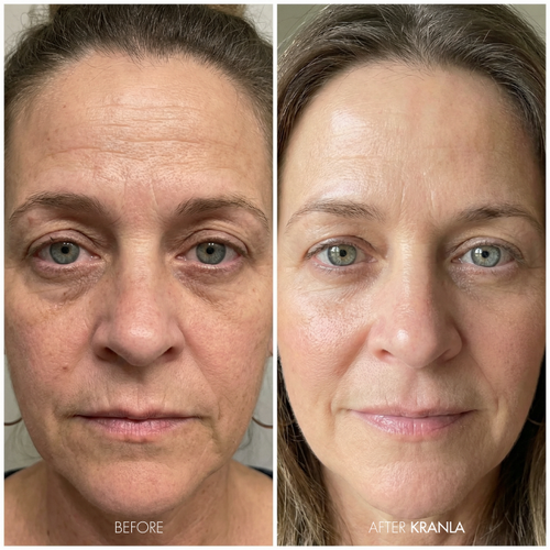 Sandra L. – Age 58