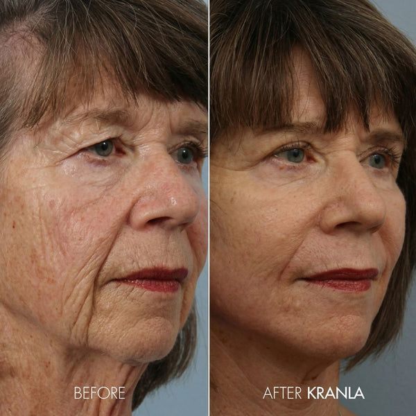 Kranla - 7 in 1 LED sculptor