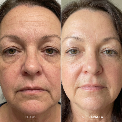 Patricia M. – Age 63