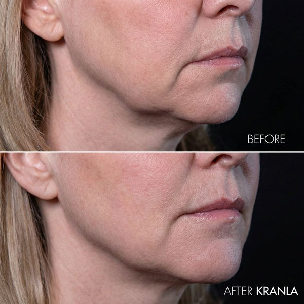 Kranla - 7 in 1 LED sculptor