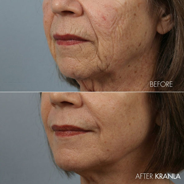 Kranla - 7 in 1 LED sculptor