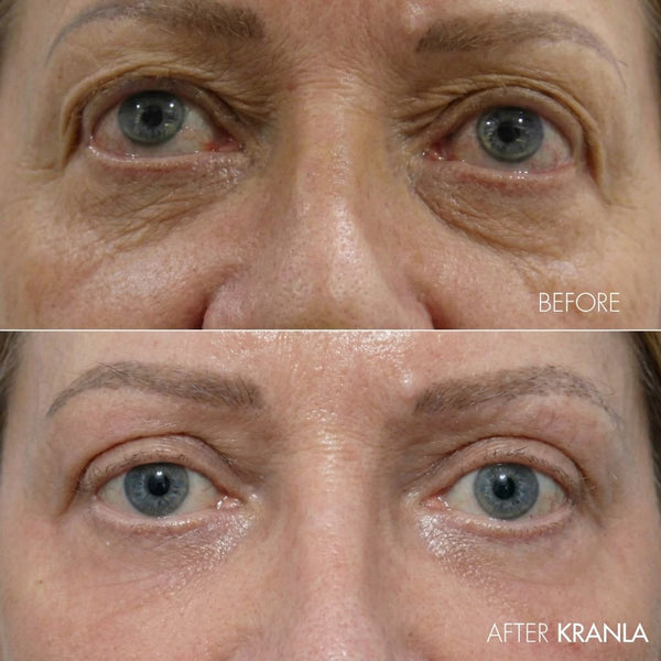 Kranla - 7 in 1 LED sculptor