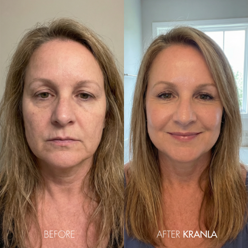 Margaret H. - Age 58