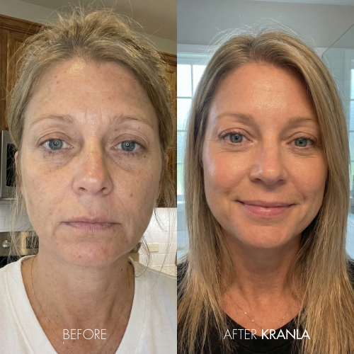 Margaret H. - Age 58