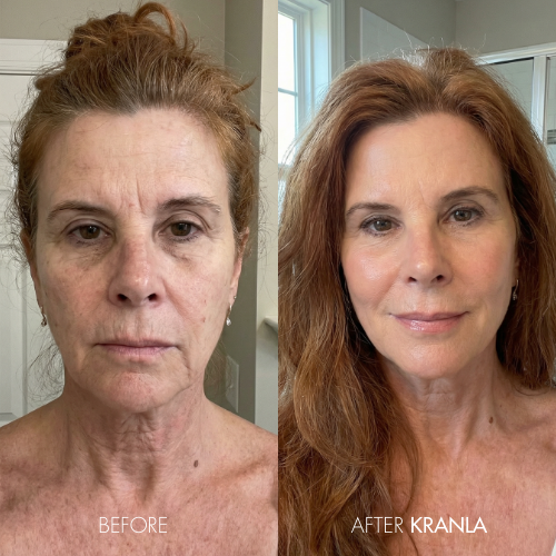 Margaret H. - Age 58