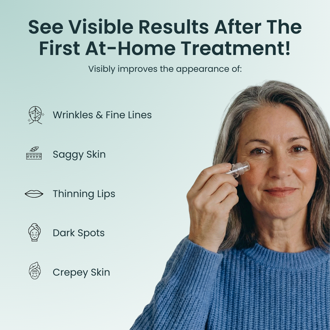 Micro Needling Infusion Kit