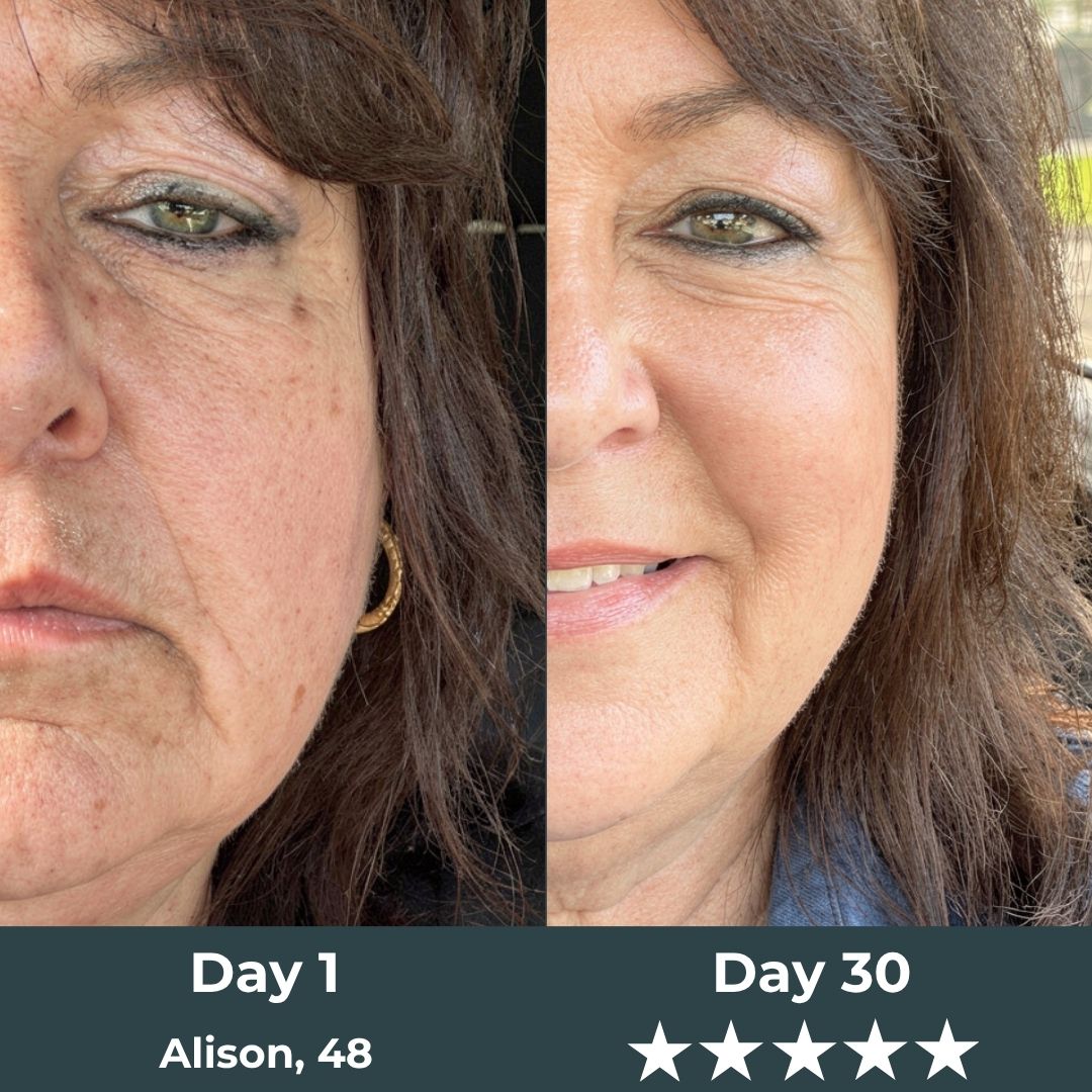 Kranla - 7 in 1 LED facial sculptor