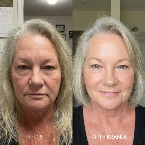 Patricia L. - Age 69