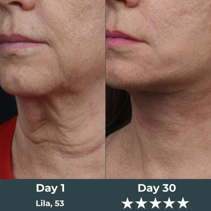 Kranla - 7 in 1 LED facial sculptor